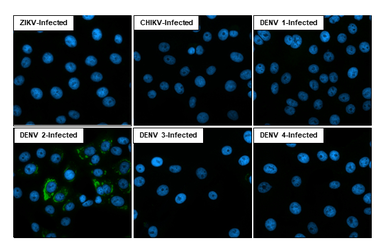 Anti-Dengue virus NS1 protein antibody [HL4997] used in Immunocytochemistry/ Immunofluorescence (ICC/IF). GTX645090